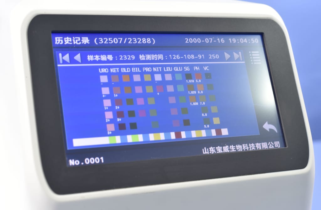 BW-300 Urine Analyzer thumb 4